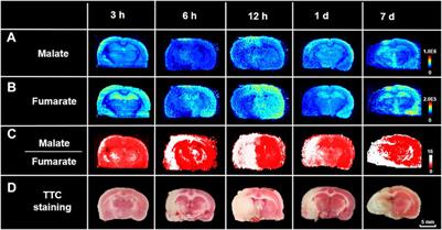 Ratiometric Mass Spectrometry Imaging for Stain-Free Delineation of Ischemic Tissue and Spatial Profiling of Ischemia-Related Molecular Signatures